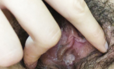 《百度雲泄密》極品美女和男友分手後玩B視頻被渣男曝光